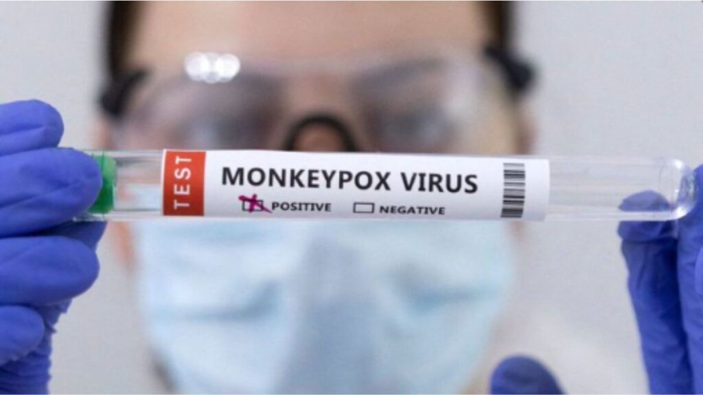 Risk Of Large Outbreak Of Monkeypox